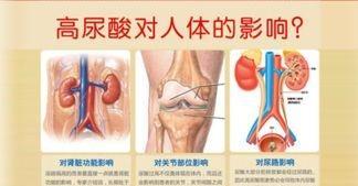 尿酸高能喝绿茶吗？